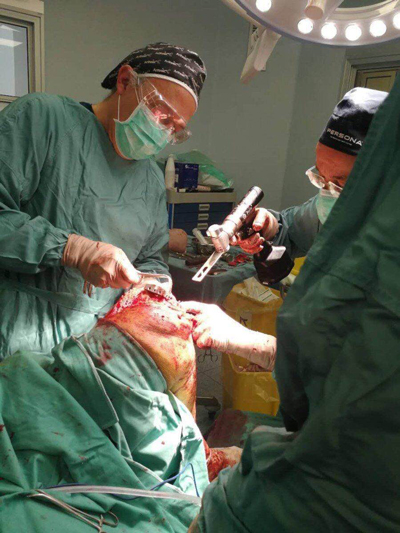 Medical-OscillatingSaw