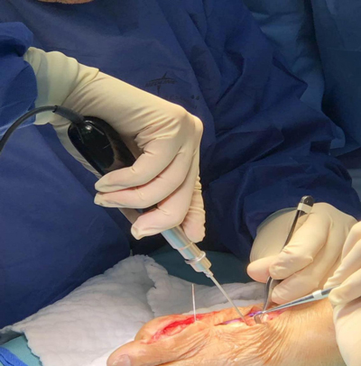 Minimally-Invasive-Surgery