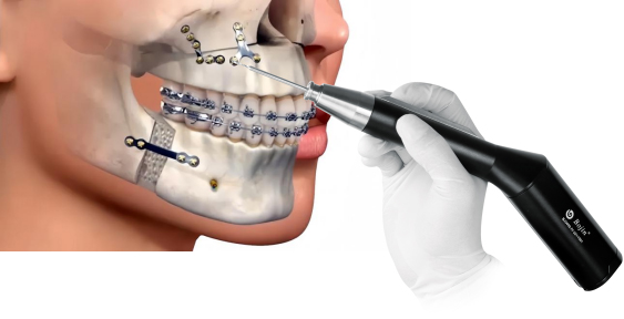 Minimally-Invasive-Techniques
