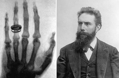 X-ray-machine.jpg