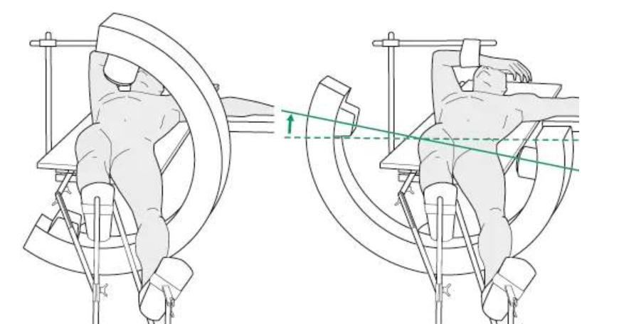 cranial drill