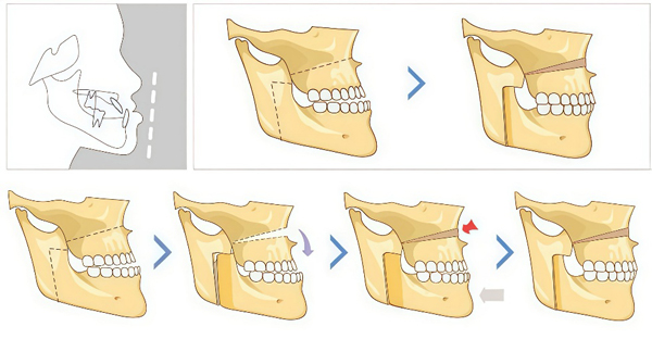 maxillofacial surgery