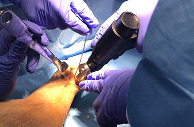 The important role of medical electric saws in surgery