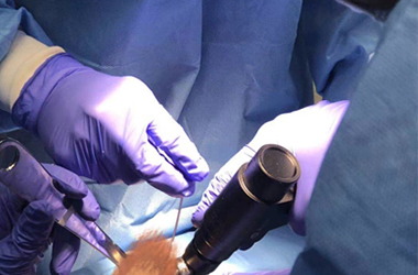 Functions and Applications of Orthopedic Saws